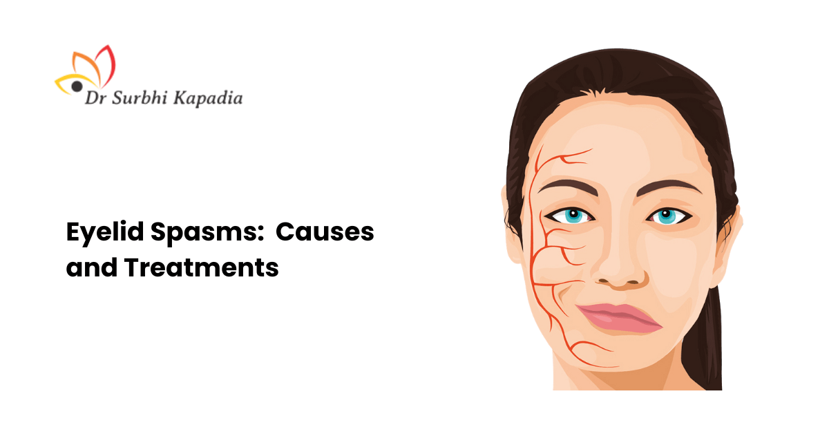 Eyelid Spasms Causes Treatments And Prevention By Dr Surbhi Kapadia 