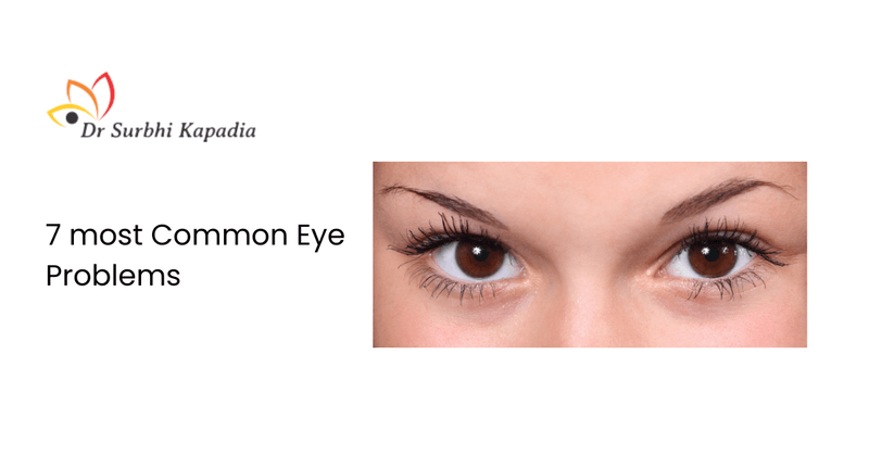 7-most-common-eye-problems
