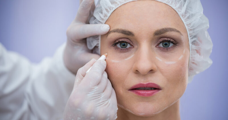 Cosmetic-Eye-Surgery-