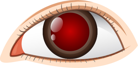 blood-in-eyes